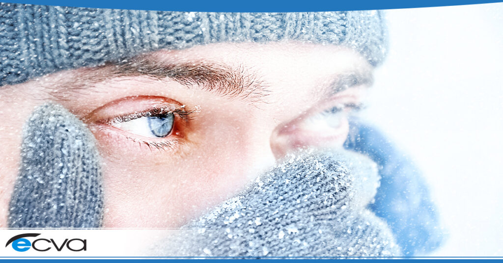 Caring for Your Eyes in Cold Weather Eye Care & Vision Associates